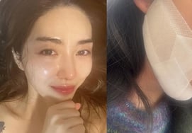 "Schlink 2nd degree burn → panic attack" Kwon Min-ah complains of depression, "I've been punished for 30 years since I was a baby."