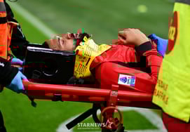 'Bị sốc' vì chảy máu mặt + gãy xương hàm, tuyển thủ quốc gia Anh ngã gục xuống bàn mổ ngay lập tức' Ra khỏi mùa giải chính thức