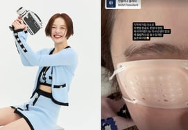 Хван Бора, даже о травме роговицы я думала только о 子Я не могла спать 한.Печальная мать-родительница".