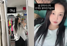 Lalalal xác nhận sau khi phẫu thuật thẩm mỹ" Nhìn ngoại hình thay đổi thì