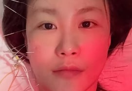 Kim Ji Min gặp sự cố ngã trong lúc chuẩn bị cho thế hệ thứ 2"Má ơi quay lại đây" Vẫn đang điều trị châm cứu