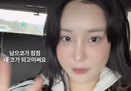 ラララ、整形手術後の満足感をアピール..「他人の鼻が自分の鼻になっている」" [スター・イシュー]