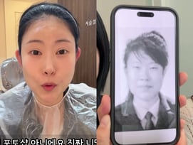'성형비=1억 5천' 이세영, 귀 필러 맞고 충격+흥분.."얼굴 짧아진 느낌"