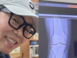 '자식농사 풍년' 정은표, 병원행 "아내 표정 좋지 않아, 잘 버티던 무릎이.." [스타이슈]