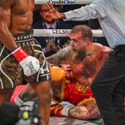 턱뼈 부러졌지만 '1360억' 벌었다! 전용기 '돈다발' 공개