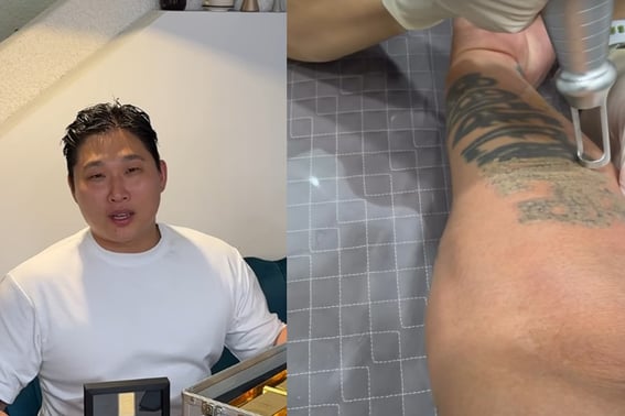 Swings xóa hình xăm trên cánh tay "Bây giờ tôi là con đường của một diễn viên". [Star Issue]