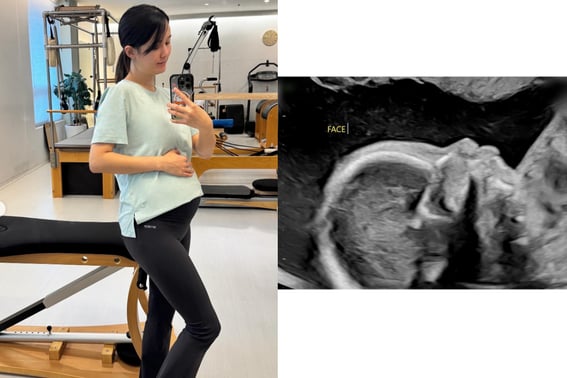 ナム・ボラ、妊娠22週の超音波を公開..「一緒に遊んでくれる人が多くて心強い」