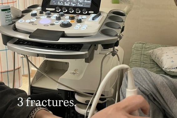 Choi Gaon trực tiếp tiết lộ về "sự gãy xương ba chỗ", rốt cuộc làm thế nào để giành được huy chương vàng… Nữ sinh cấp 3 18 tuổi 'Tinh thần chiến đấu tuyệt vời nhất' [Thế vận hội Milan]