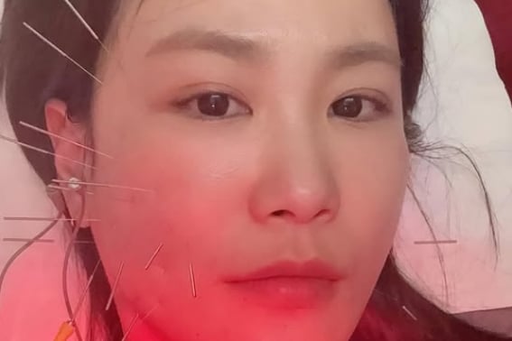 "You'll be back, won't you?"" Kim Ji-min's cheek recessed due to a fall accident..I put my spit on my face