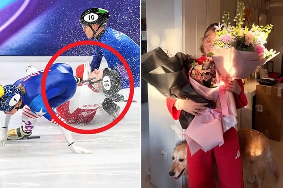 Звезда шорт-трека "Лицевые лопатки в день катания" и печальная недавняя "половина" лица после операции "почти лишилась глаз"."