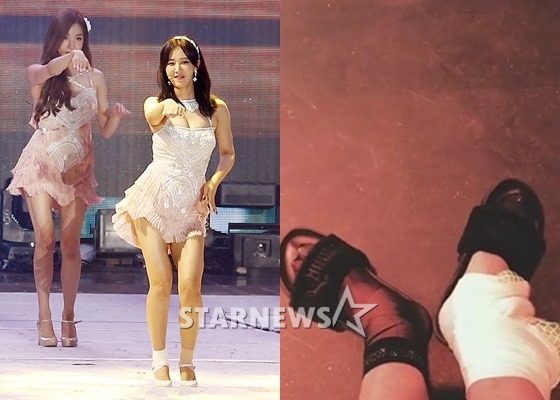 소녀시대 유리의 공연 모습(왼쪽)과 유리가 SNS에 공개한 발목 부상 사진