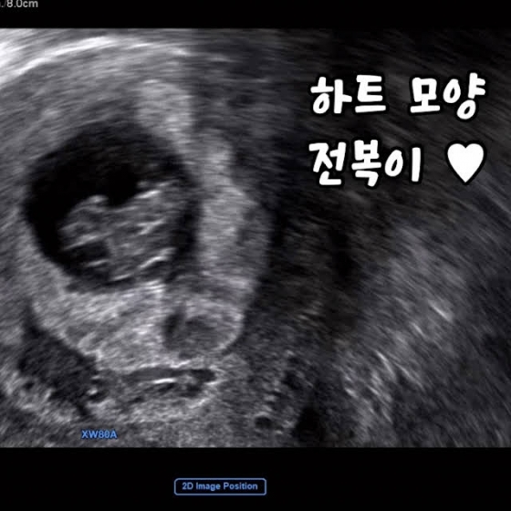 /사진=김다예