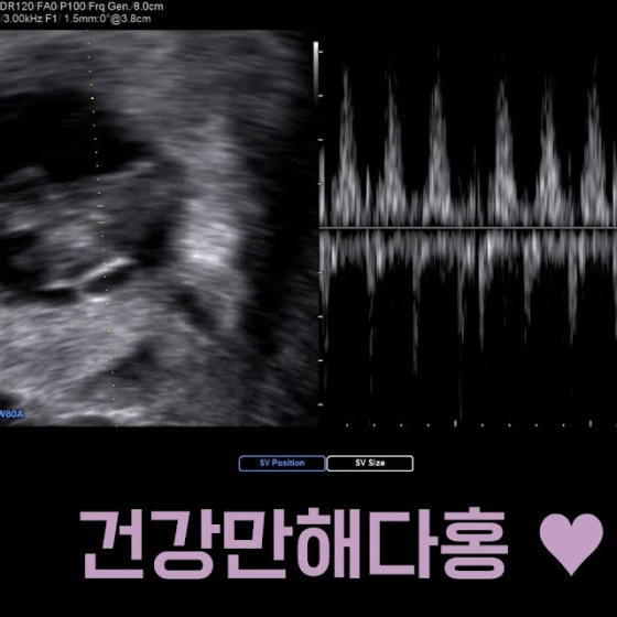 /사진=김다예