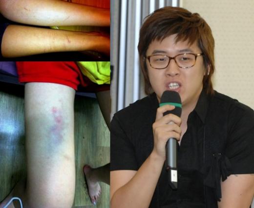 김미리내가 미니홈페이지에 공개한 폭행당한 사진(왼쪽)과 개그맨 이상구