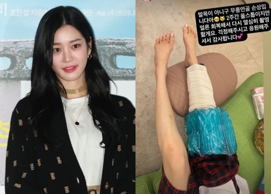 이유비 / 사진=스타뉴스, 인스타그램