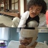 '닥터스', 평생 반쪽 얼굴로 살아온 사연 소개
