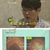윤형빈, 16일 유암종 성공적 수술 ..병원서 회복중