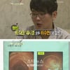 '유암종' 수술 윤형빈, 부모 간호 속 오늘 퇴원