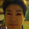 산이 "선홍빛 눈가..쌍꺼풀수술(?) 했어요"