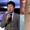 남희석, 아내 화상에 분노 "고데기 폭발. 실명할 뻔"