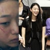 '도수코3' 최소라, 심야 한강공원서 얼굴 피습 