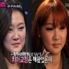 성수진, 양악수술후 'K팝스타'2 도전..'합격'