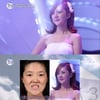 '렛미인' 김은애씨 "이혼 강요당했던 외모..괄목상대"