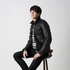 '오로라' 오창석, 6일 팔 수술.."철심 제거"