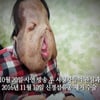 심현희씨, 재활치료 도중 사망..'세상에 이런일이' 통해 사연 소개