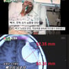 '미우새' 빽가 "뇌종양 투병..'명복을 빈다' 악플에 고통"