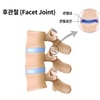 [신승준 척추비법] 후관절 낭종
