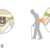 [김태겸, 척추이야기] 허리 통증, 척추 협착증 의심