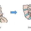 [김태겸, 척추이야기] 허리통증 지속? 척추전방전위증