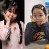 정종철, 딸 시아 '쌍꺼풀 애프터' 공개 "쌍수♥ 어때요?"[스타IN★]