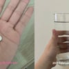  이대병원 , 유방암 극복하기 프로젝트