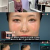 이세영, "남친과 코수술"..가상 성형에 만족도 UP [스타이슈]