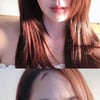 유진, 얼굴에 상처가.."차가운 침대 위에 누웠던 날"[스타IN★]