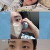 최희, 안면마비로 입원 당시 공개 "출산보다 아파..재활 집중"[스타이슈]