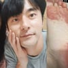 윤주만, 수족구병 감염 후 걱정되는 발 상태 "좋아짐"[스타IN★]