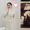 써니힐 빛나, 결혼 1년만 임신.."아직도 조심스러워"