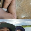 기안84, 이시언과 남미 여행중..흡혈 파리 뜯긴 상처