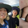 기안84, 남미 여행 후 상처투성이 다리 공개.."힘드네"