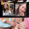 백반증 의뢰女 "얼룩말 같단 말 상처..승무원 꿈도 접어"[물어보살][★밤Tview]