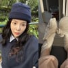 장재인, 양발에 심재성 2도 화상‥붕대로 꽁꽁 싸맨 발