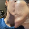 "하혈하고 얼굴에 열꽃" 유깻잎, 충격적 독감 후유증