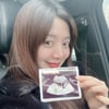 차쿤♥송채윤, 2세 임신→초음파 사진 공개.."성별은 딸"