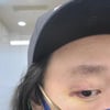 김경진, 시퍼렇게 멍들고 찢어진 눈..아찔했던 응급실行