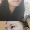 혜박, 점 빼고 확 달라진 분위기 "왜 이제 했을까 후회.."