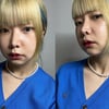 10기 영자, 양악·광대·턱 수술 후.."전이 나아" 악플