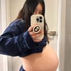 '안용준♥' 베니, 긴급 수술 들어간다.."혈압+단백뇨 수치 때문"